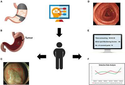 Use of Artificial Intelligence to Improve the Quality Control of Gastrointestinal Endoscopy